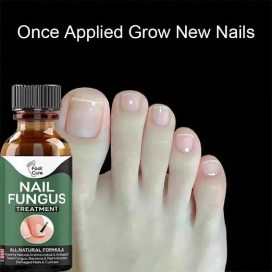 Nail Fungus Treatment – 10ml