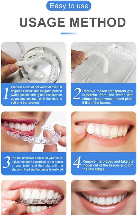 Snap-On Smile Veneers – Moldable False Teeth Kit for Men & Women